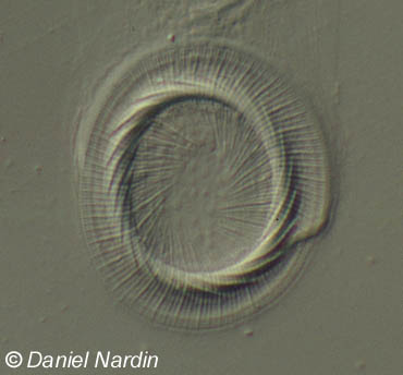 Trichodine: vue de la rgion buccale